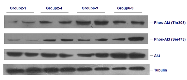 蛋白印迹(Western Blot)实验HJC黄金城平台