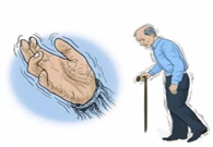 帕金森。芭痢辈慌？