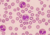 一种神秘颗粒被发现了！它能否成为败血症早筛标志物？