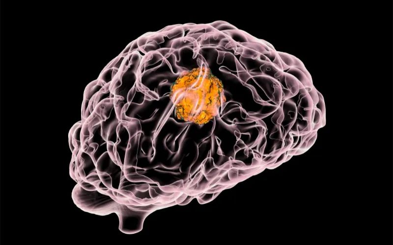 HJC黄金城平台助力 | 璧辰医药ABM-1310获美国FDA孤儿药资格认证，用于治疗携带BRAF V600突变的脑胶质母细胞瘤患者